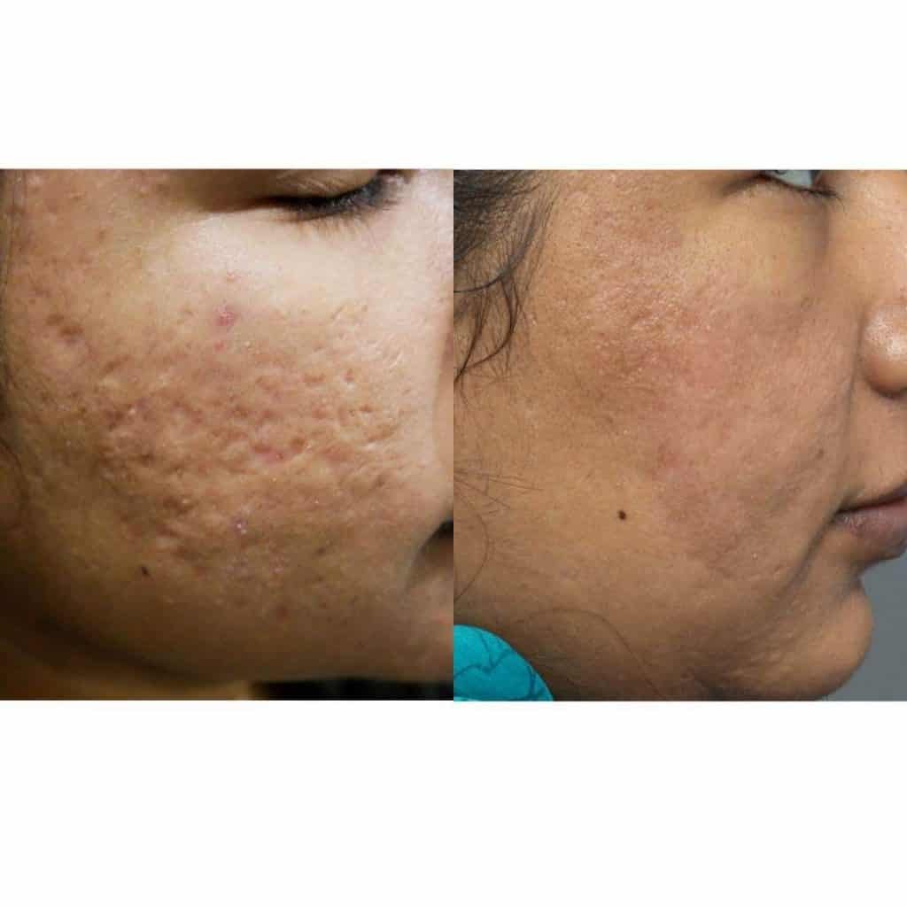 Cosmetic Surgery Before and After Case 1